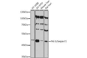 Western blot analysis of extracts of various cell lines, using PAI-1/Serpin E1 antibody (ABIN6131329, ABIN6147600, ABIN6147602 and ABIN6215676) at 1:3000 dilution. (PAI1 Antikörper  (AA 24-158))