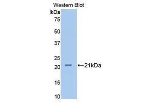 Western Blotting (WB) image for anti-Fibulin 1 (FBLN1) (AA 347-521) antibody (ABIN1175708) (Fibulin 1 Antikörper  (AA 347-521))