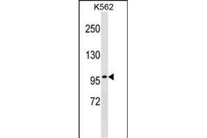 ITGB2 Antibody (ABIN1539991 and ABIN2837841) western blot analysis in K562 cell line lysates (35 μg/lane). (Integrin beta 2 Antikörper)