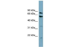 WB Suggested Anti-CPT1B Antibody Titration:  0. (CPT1B Antikörper  (Middle Region))