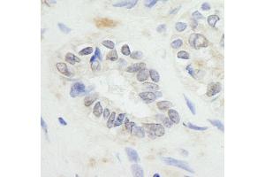 Immunohistochemistry (IHC) image for anti-Ring Finger Protein 20 (RNF20) (AA 125-175) antibody (ABIN7448779) (RNF20 Antikörper  (AA 125-175))