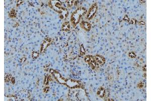 ABIN6272870 at 1/100 staining Mouse kidney tissue by IHC-P. (IFT140 Antikörper  (Internal Region))
