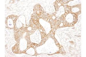 Immunohistochemistry (IHC) image for anti-Catenin, beta (CATNB) (AA 760-781) antibody (ABIN7448432) (beta Catenin Antikörper  (AA 760-781))