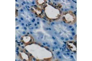 Immunohistochemical analysis of GSTT1 staining in human kidney formalin fixed paraffin embedded tissue section.