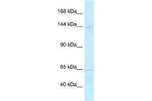 WB Suggested Anti-MYBBP1A Antibody Titration: 1.
