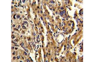 Immunohistochemistry (IHC) image for anti-ATP-Binding Cassette, Sub-Family G (WHITE), Member 1 (ABCG1) (AA 359-387) antibody (ABIN3030059)