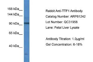 Western Blotting (WB) image for anti-Transcription Termination Factor, RNA Polymerase I (TTF1) (Middle Region) antibody (ABIN2788733) (TTF1 Antikörper  (Middle Region))