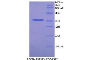 SDS-PAGE analysis of Rat NEK2 Protein.