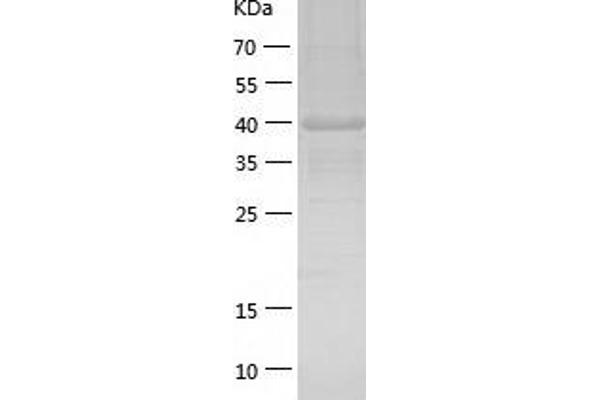 HAO1 Protein (AA 1-370) (His tag)