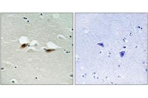Immunohistochemistry analysis of paraffin-embedded human brain, using ATF-2 (Phospho-Ser472) Antibody. (ATF2 Antikörper  (pSer472))