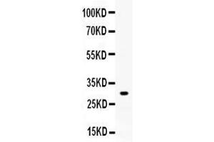 Western blot analysis of ZWINT expression in rat skeletal muscle extract ( Lane 1). (ZWINT Antikörper  (AA 29-249))