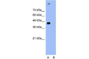 Western Blotting (WB) image for anti-TAR DNA Binding Protein (TARDBP) (N-Term) antibody (ABIN2780848)