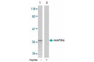 Western blot analysis of extracts from MDA-MB-435 cells using MAP2K6 polyclonal antibody . (MAP2K6 Antikörper  (Ser207))