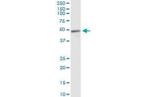 MECP2 monoclonal antibody (M01), clone 4B6. (MECP2 Antikörper  (AA 81-170))