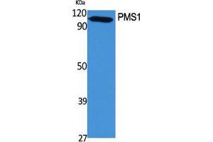 Western Blot (WB) analysis of specific cells using PMS1 Polyclonal Antibody. (PMS1 Antikörper  (Internal Region))