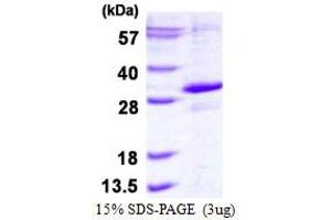 Image no. 1 for Egl-9 Family Hypoxia Inducible Factor 3 (EGLN3) (AA 1-239) protein (His tag) (ABIN6386986)