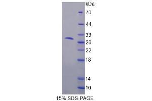 SDS-PAGE analysis of Mouse MCCC1 Protein. (MCCC1 Protein)