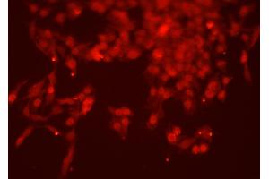 ABIN6263769 and ABIN6277767 staining HEPG2 cells by ICC/IF. (NUMB Antikörper  (C-Term))