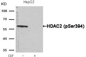 Western Blotting (WB) image for anti-Histone Deacetylase 2 (HDAC2) (pSer394) antibody (ABIN7138595)