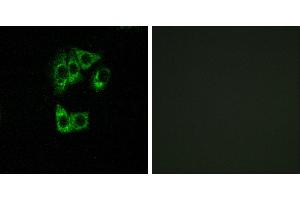 Peptide - +Western blot analysis of extracts from HT-29 cells, using GIMAP2 antibody. (GIMAP2 Antikörper  (Internal Region))