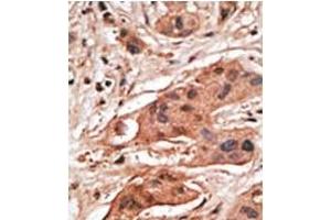 Image no. 2 for anti-BCL2-Related Protein A1 (BCL2A1) (BH3 Domain), (N-Term) antibody (ABIN356809)