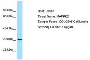 Image no. 1 for anti-Microtubule-Associated Protein, RP/EB Family, Member 2 (MAPRE2) (AA 157-206) antibody (ABIN6750058) (MAPRE2 Antikörper  (AA 157-206))