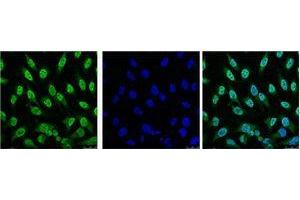 Immunofluorescence (IF) analysis of Hela with antibody (Left) and DAPI (Right) diluted at 1:100. (p53 Antikörper)