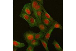 anti-Nibrin (NBN) (AA 714-745), (C-Term) antibody