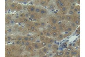 Immunohistochemistry (IHC) image for anti-Interleukin 1 Receptor, Type I (IL1R1) (AA 21-109) antibody (ABIN7430735)