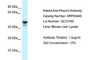 Western Blotting (WB) image for anti-Phosphatase and Actin Regulator 3 (PHACTR3) (Middle Region) antibody (ABIN2785397)