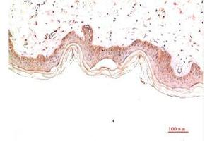 Immunohistochemical analysis of paraffin-embedded Human Skin Tissue using Collagen IV Mouse mAb diluted at 1:2000 (COL4A1 Antikörper)