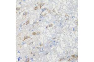 Immunohistochemistry of paraffin-embedded rat brain using CHIC2 antibody (ABIN5974773) at dilution of 1/100 (40x lens). (CHIC2 Antikörper)