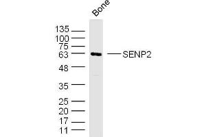 Mouse bone lysates probed with SENP2 Polyclonal Antibody, unconjugated  at 1:300 overnight at 4°C followed by a conjugated secondary antibody for 60 minutes at 37°C. (SENP2 Antikörper  (AA 1-100))