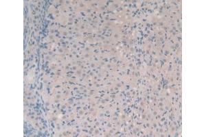 IHC-P analysis of Mouse Ovary Tissue, with DAB staining. (SYN1 Antikörper  (AA 113-420))