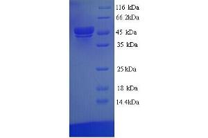 SDS-PAGE (SDS) image for TEA Domain Family Member 1 (SV40 Transcriptional Enhancer Factor) (TEAD1) (AA 1-426), (full length) protein (His tag) (ABIN5713882)