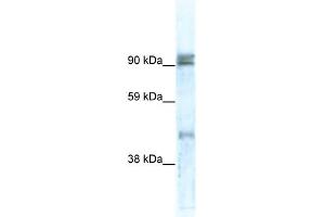 WB Suggested Anti-ZNF227 Antibody Titration:  0. (ZNF227 Antikörper  (N-Term))
