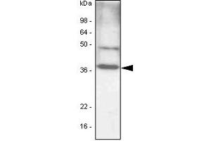 The cell lysates (40ug) were resolved by SDS-PAGE, transferred to PVDF membrane and probed with anti-human C/EBP-beta antibody (1:1000). (CEBPB Antikörper)