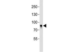 Western blot analysis of lysate from MCF-7 cell line using BRAF antibody. (BRAF Antikörper  (AA 580-609))