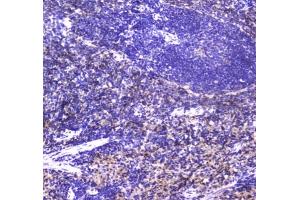 IHC testing of FFPE rat spleen tissue with NKp46 antibody at 1ug/ml.