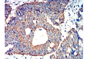 Immunohistochemistry (IHC) image for anti-ATG3 Autophagy Related 3 (ATG3) (AA 1-100) antibody (ABIN5611291)