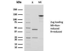 SDS-PAGE Analysis Purified Smooth Muscle Actin MAb (1A4 + ACTA2/791). (Smooth Muscle Actin Antikörper  (N-Term))
