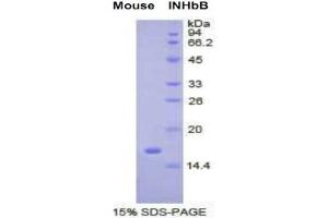 SDS-PAGE analysis of Mouse Inhibin beta B Protein.
