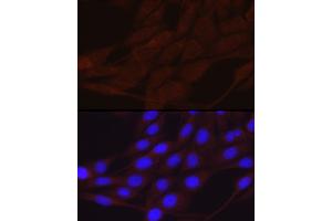 Immunofluorescence analysis of NIH/3T3 cells using SCNN1A Rabbit pAb (ABIN6129465, ABIN6147447, ABIN6147448 and ABIN6221186) at dilution of 1:200 (40x lens). (SCNN1A Antikörper  (AA 105-225))