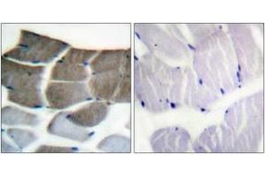Immunohistochemistry analysis of paraffin-embedded human skeletal muscle tissue, using ACC1 (Ab-80) Antibody. (Acetyl-CoA Carboxylase alpha Antikörper  (AA 46-95))