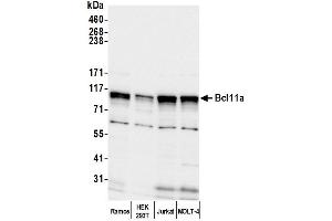 Western Blotting (WB) image for anti-B-Cell CLL/lymphoma 11A (Zinc Finger Protein) (BCL11A) (AA 1-50) antibody (ABIN7449671)