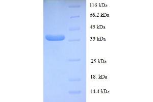 SDS-PAGE (SDS) image for General Transcription Factor IIE, Polypeptide 2 (GTF2E2) (AA 1-291), (full length) protein (His tag) (ABIN5709625) (GTF2E2 Protein (AA 1-291, full length) (His tag))