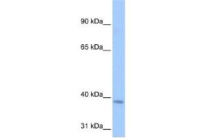 WB Suggested Anti-NSUN3 Antibody Titration:  0. (NSUN3 Antikörper  (C-Term))