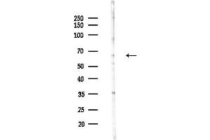 anti-Chromodomain Protein, Y-Like (CDYL) (C-Term) antibody