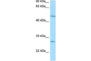 WB Suggested Anti-Entpd1 Antibody Titration: 1. (CD39 Antikörper  (N-Term))