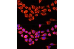 Immunofluorescence analysis of 293T cells using AADAC antibody (ABIN6129182, ABIN6136311, ABIN6136313 and ABIN6218113) at dilution of 1:100 (40x lens). (AADAC Antikörper  (AA 170-399))